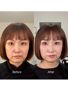 ハッピーアリスター(HAPPY ALISTER)/メイクビフォーアフター