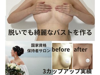 ビサンテ(Vi sante)