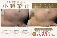 ウィンウィン 新山口店(Win Win)
