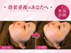 リノ 池袋(LINO)の写真