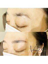 クレー(Klee)/アイブロウリフト