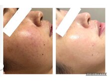 オアジスパ(Oasi Spa)/ＤＴありハーブ５回