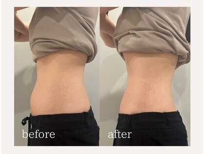 フラットベリー 恵比寿(Flat BELLY)の写真