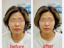 六角橋つつみ接骨院/お顔のむくみ等お悩みの方にも◎