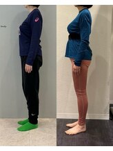 ホリック アイス コア ボディ(HOLIC ICE CORE BODY)/お客様のビフォーアフター8