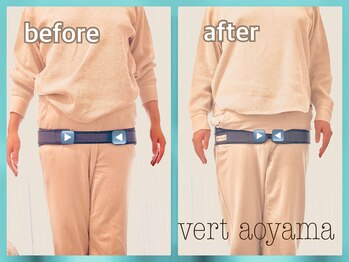 ヴェール 青山(vert)/骨盤矯正ビフォーアフター