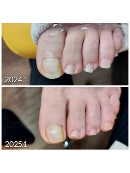 爪切り屋 足楽/