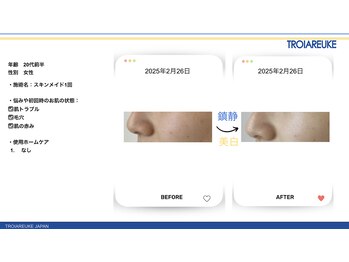 リトルーム(Litroom: from Seoul)/スキンメイド