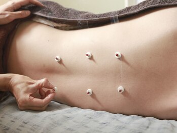 ロミアオ(Lomi-AO)/マタニティ☆胃の六つ灸