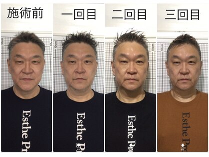 自然美人の写真