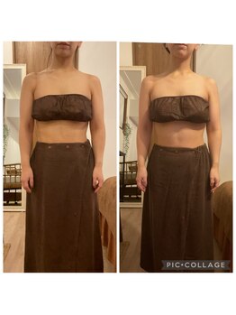 リス(LYS)/[大阪江坂/上半身痩身]60分×4回