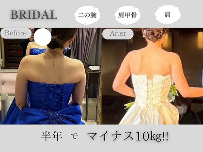 ラヴニール(L'avenir)の写真