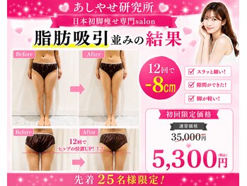 メディカルエステ 大宮店の写真/【あしやせ研究所独自メゾットで暴飲暴食に短期集中】とにかく本気で痩せたい方!痩身専門施術で全身痩せ◎
