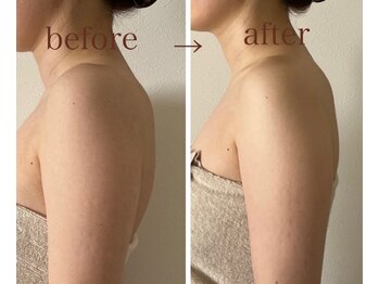 ナチューラ(Natura)/一度の施術で猫背矯正★★★