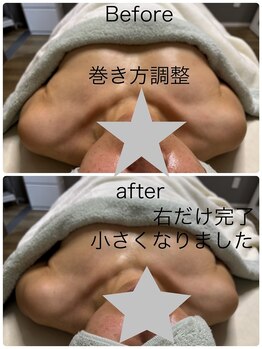 ベッピン(Beppin)/バストケア/筋膜リリース静岡