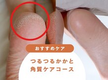 パラスパガーデン 福岡(para spa GARDEN)の雰囲気（ひび割れ・カサカサかかと改善の角質ケアコース☆福岡/天神）