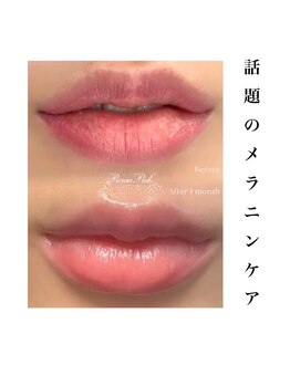 ツキ(TSUKI)/ローマピンク　唇