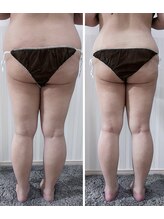 アイナ(aina)/お得な継続チケットあります