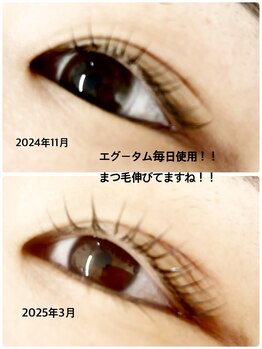 ネイルアンドエステティック デイズ 三好中央店(Days)/まつ毛美容液
