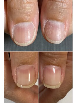 サンマルイチ(301)/ビフォーアフター