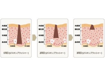 ハイビ(Hibi)/◆シミの原因にピンポイント◆