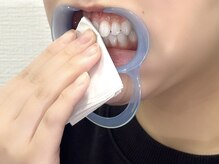 ホワイトニングバー 心斎橋オーパ店/水分除去で効果アップ