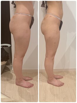 ありひ/セルゼロの効果(下半身)