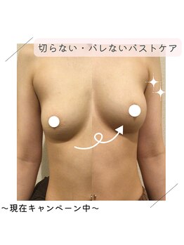 クレット 銀座店(Cret)の写真/[銀座駅/東銀座駅近]気持ちも,人生さえも変えられる~【人気No.1バスト/上半身痩身お悩み改善コース￥8000】