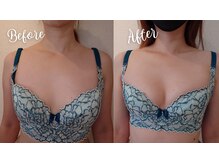 サロンハナ(Salon HANA)の雰囲気(ベテランの技術+光+ナノカレント効果で戻らないバスト)