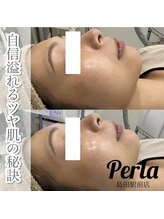 ぺルラ 島田駅前店(Perla)/光フェイシャル