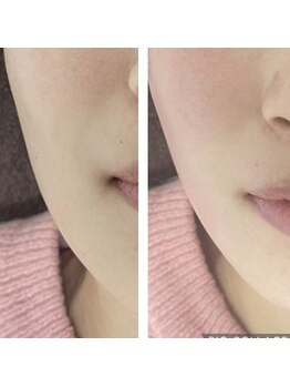 ナナマルニ 高知店(702)/くすみやトーンアップも実感★