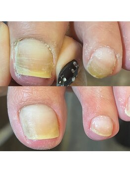 ロータス(LOTUS)/爪周辺フットケア付ジェル☆