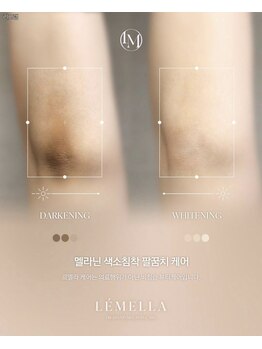 ミタス(Me+)/メラニンケア【ルメラ】ヒザ