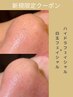 《毛穴洗浄×皮膚回復》ハイドラ＋白玉フェイシャル¥11000