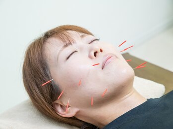 おいけ接骨院 太田藪塚院/美容鍼×全身整体