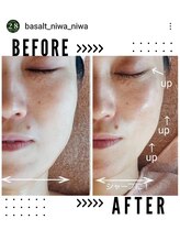 ニワ(Niwa)/バザルトフェイシャル50分