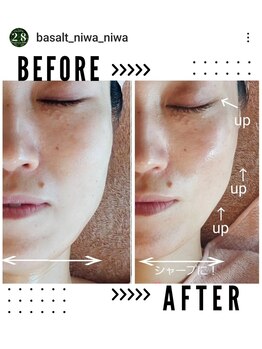 ニワ(Niwa)/フェイシャル施術例