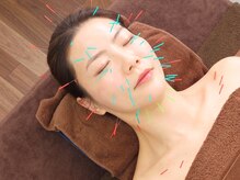 リケア 西新宿鍼灸院(reCare)の雰囲気(小顔やシワ改善に期待できる女性に人気の美容鍼灸コース)