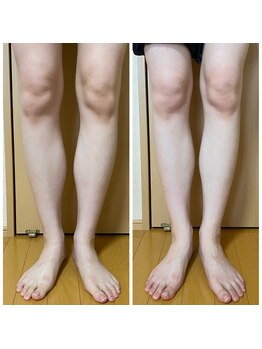 ヨサパーク オリーブ 小倉南店(YOSA PARK olive)/たった1回でこの効果♪