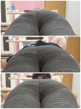 エミナル(EMINAL)/骨盤調整