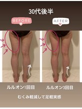 ヨサパーク ラブリエ 吉祥寺店(YOSA PARK La Briller)/30代後半