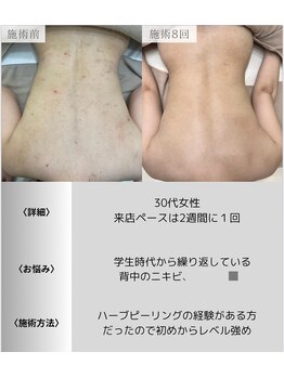 サロンエヌ 久留米店(Salon N)/ブライダルにも◎