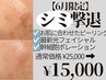 【6月限定シミケア】ピーリング+光フェイシャル+幹細胞ポレーション¥25000→