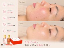 アネラ(ANELA)の雰囲気（ララピール　水光美肌　韓国肌管理）