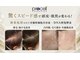 テテ ソワン(tete-soin)の写真/《プロセルセラピーズ》【頭皮育×肌育】最先端頭皮ケアでお悩みを徹底改善！人生が変わる体験を◎