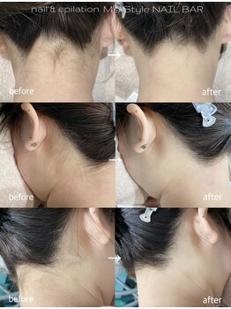 エムズスタイル ネイルバー(M's Style NAIL BAR)/うなじ脱毛