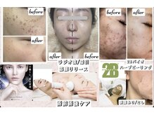 サロンドシェリ 人形町 水天宮前の雰囲気（結果出し重視認定サロン☆お客様の理想に合わせて徹底ヒアリング）