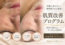 サロンド ソラ(Salon de SoLA)