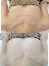 ワイサロン(Y salon)/バストアップ/4ヶ月/D→Eカップ