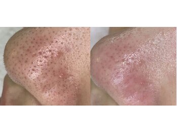 ジェリー(JERRY)/つるんつるん